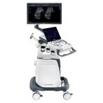 Ecógrafo Sonoscape P25